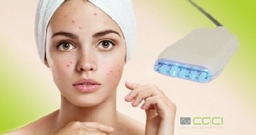 Caci  non surgical Treatments
